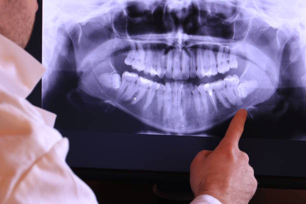 Best Emergency Treatment for Oral Infections in Moundsville, WV